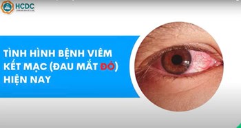 Đau mắt đỏ cần lưu ý điều gì?