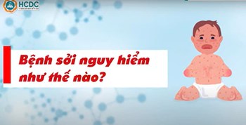 Những điều cần biết về bệnh sởi