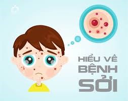 HCDC - Podcast- Trẻ cần tiêm đủ 2 mũi vắc xin phòng sởi