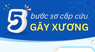 5 bước sơ cấp cứu gãy xương