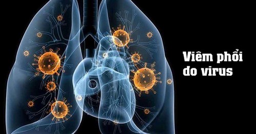 Tuyên truyền phòng, chống bệnh viêm phổi nặng do virus