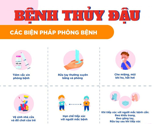 Bệnh thủy đậu - Một số điều cần lưu ý