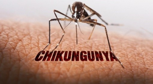 Bệnh Chikungunya