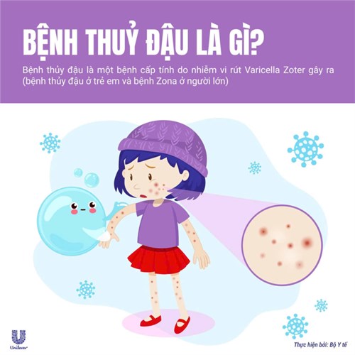 Tuyên truyền phòng bệnh Thủy đậu