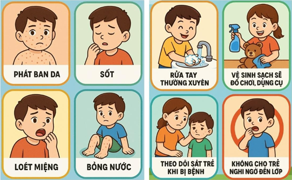 Truyền thông y tế: Cảnh báo tác nhân EV71 (Enterovirus 71) liên quan đến bệnh tay chân miệng xuất hiện trở lại
