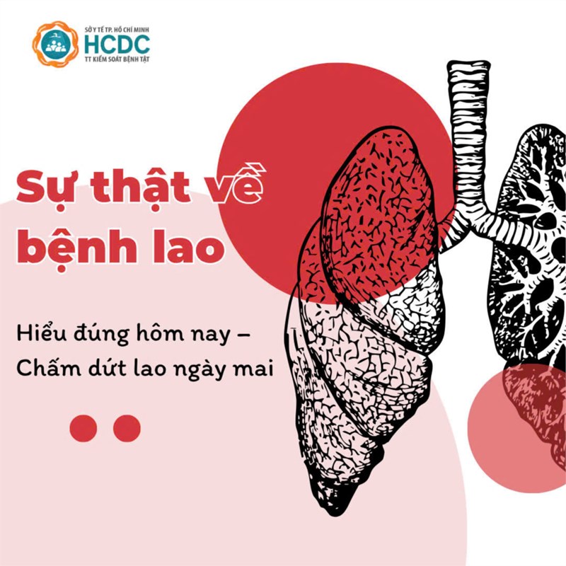 <a href="/y-te/tuyen-truyen-ve-benh-lao/ctfull/79184/746186">Tuyên truyền về bệnh lao</a>