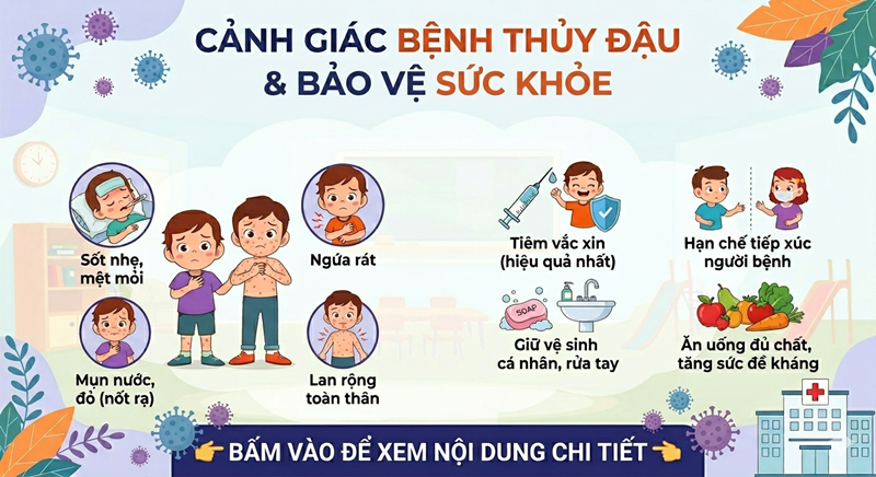 Cảnh giác bệnh thủy đậu (Trái rạ)